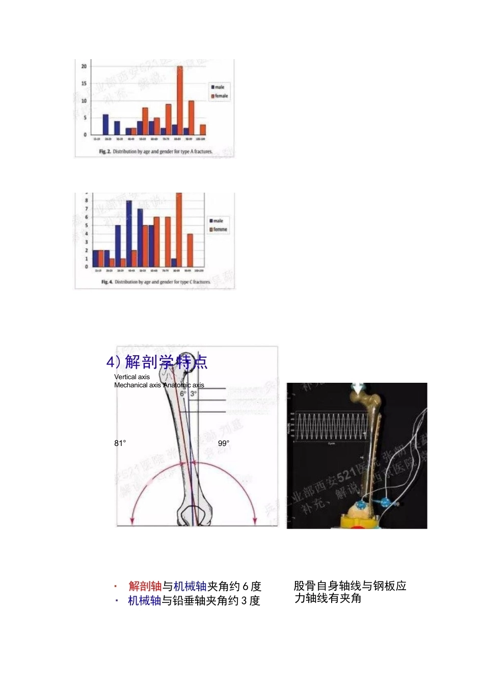 股骨远端骨折的手 术治疗技巧_第7页