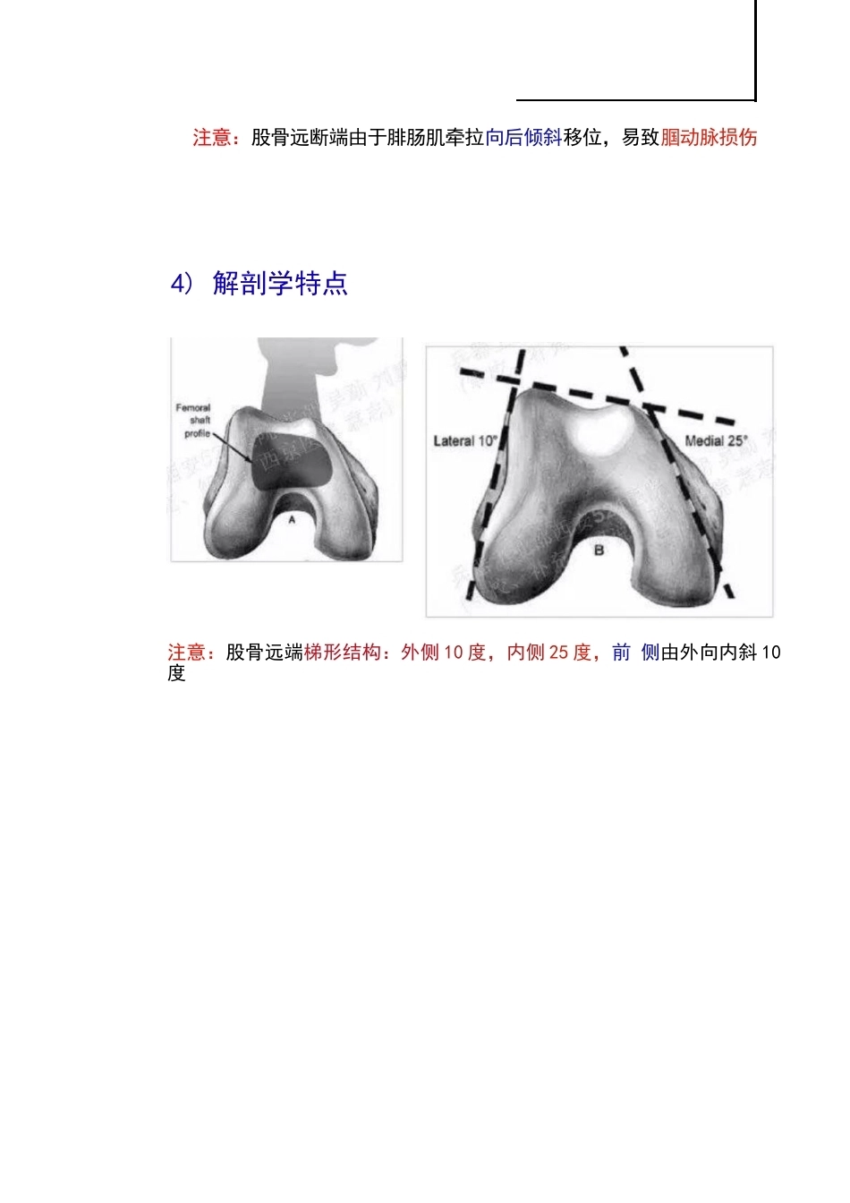 股骨远端骨折的手 术治疗技巧_第9页