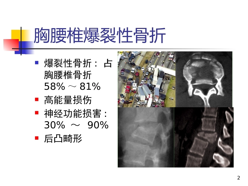 胸腰椎爆裂性骨折的 治疗_第2页