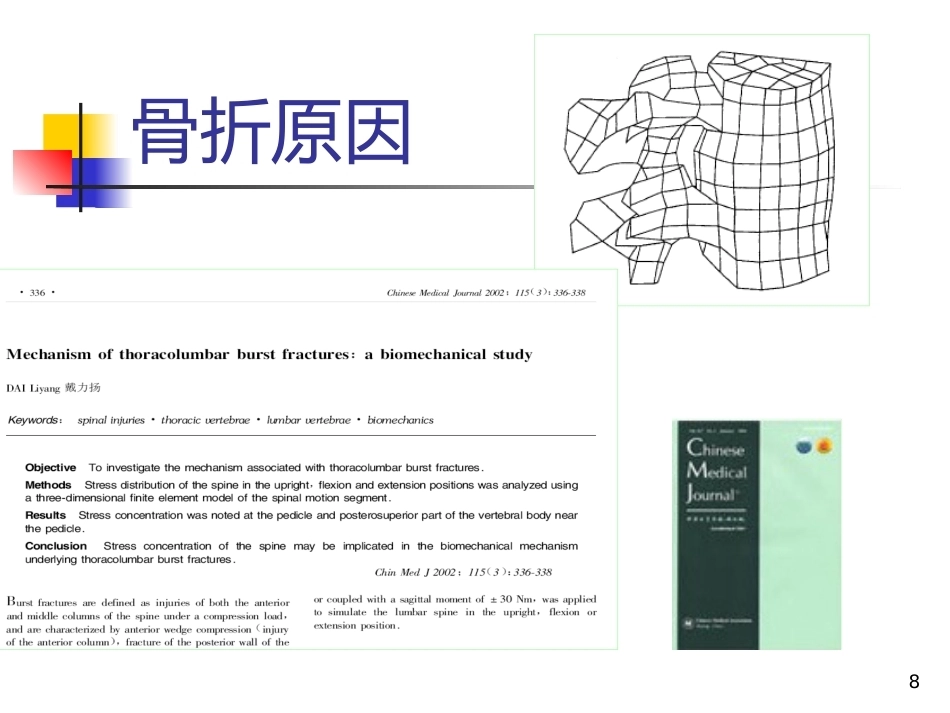 胸腰椎爆裂性骨折的 治疗_第8页