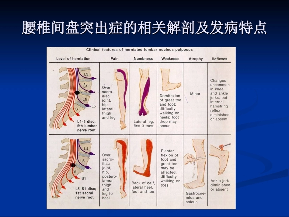 腰椎间盘突出症的诊断、鉴别诊断与分型_第10页