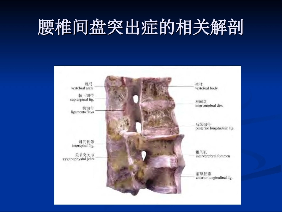 腰椎间盘突出症的诊断、鉴别诊断与分型_第4页