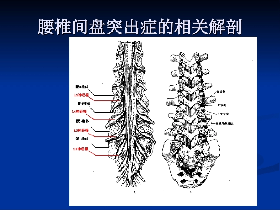 腰椎间盘突出症的诊断、鉴别诊断与分型_第7页