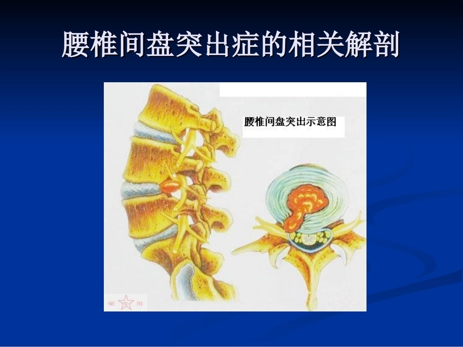 腰椎间盘突出症的诊断、鉴别诊断与分型_第8页
