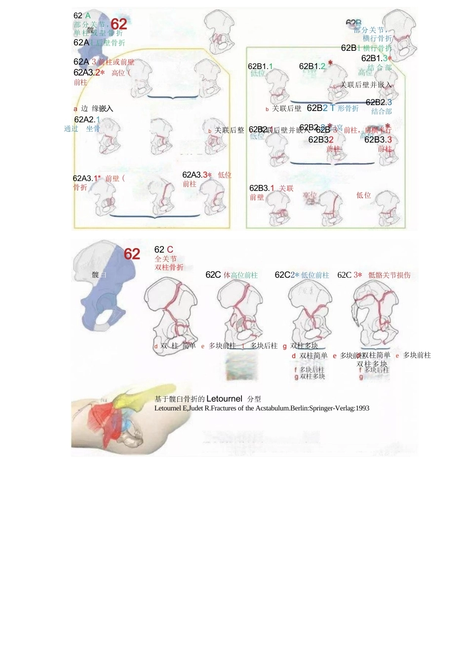 AO骨折分型-脊柱、骨盆部分_第7页
