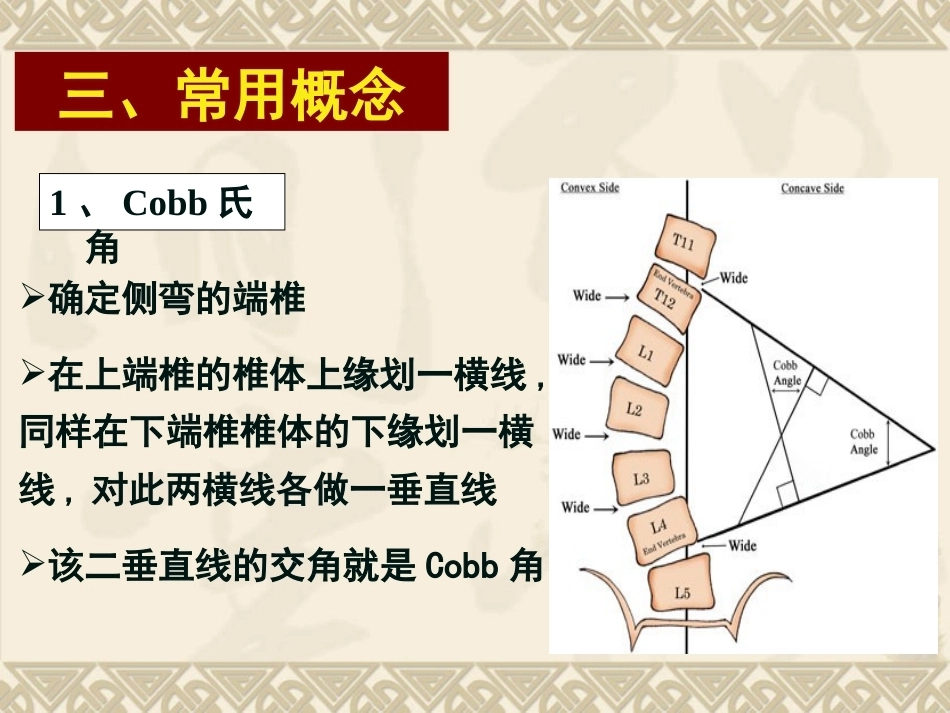 脊柱侧弯的治疗 与对策_第4页