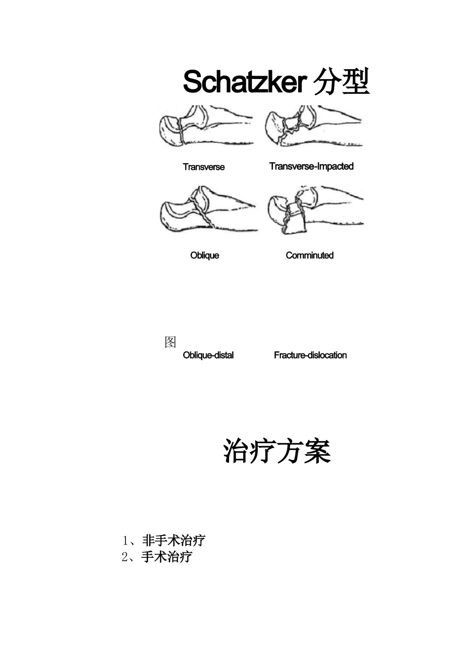 尺骨鹰嘴骨折的手术分型_第10页