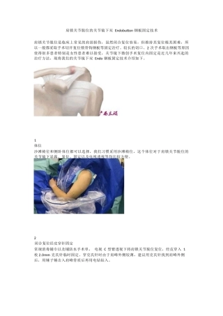 肩锁关节脱位的关节镜下双Endobutton钢板 固定技术