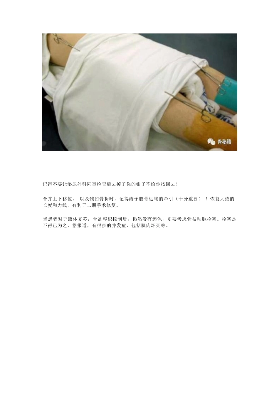 骨盆骨折的急 救治疗_第10页