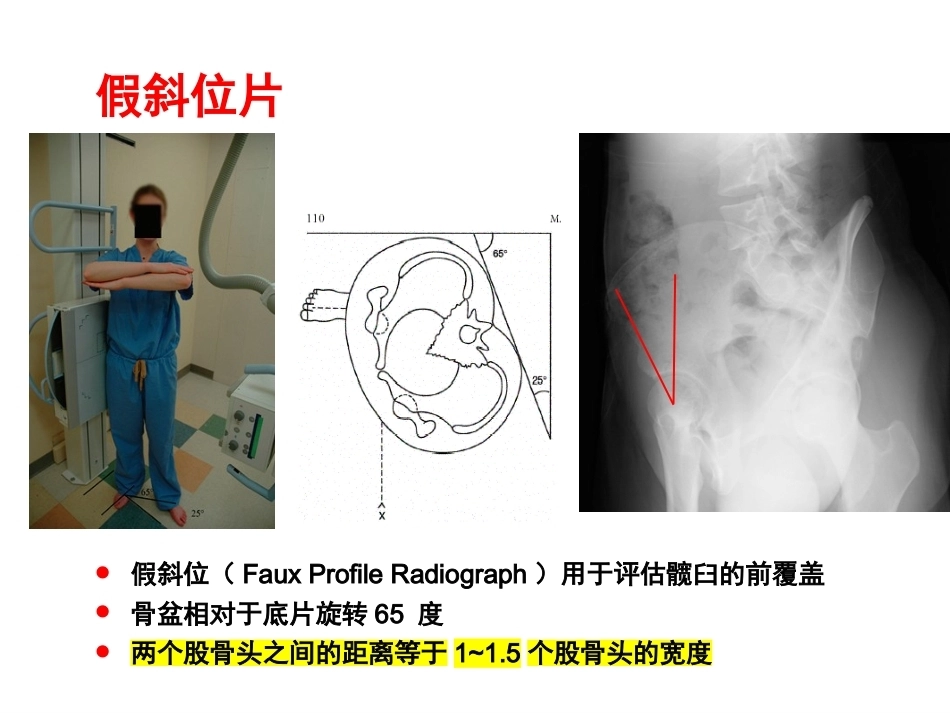 成人影像学_第7页