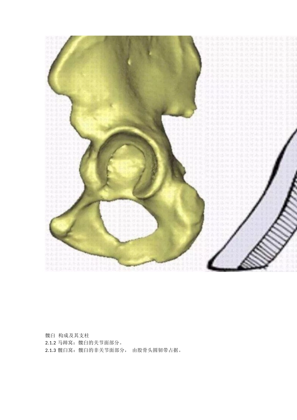 髋臼骨折分型_第2页