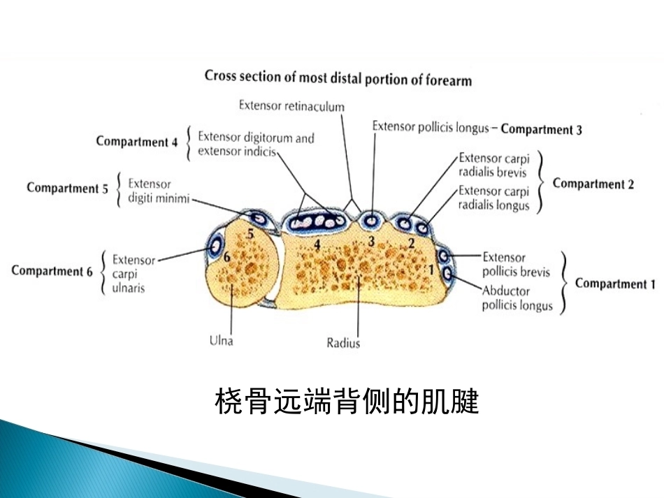 桡骨远端骨折课件_第13页