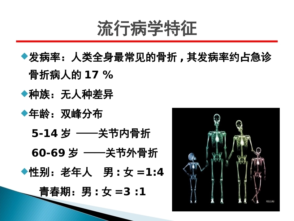 桡骨远端骨折课件_第4页