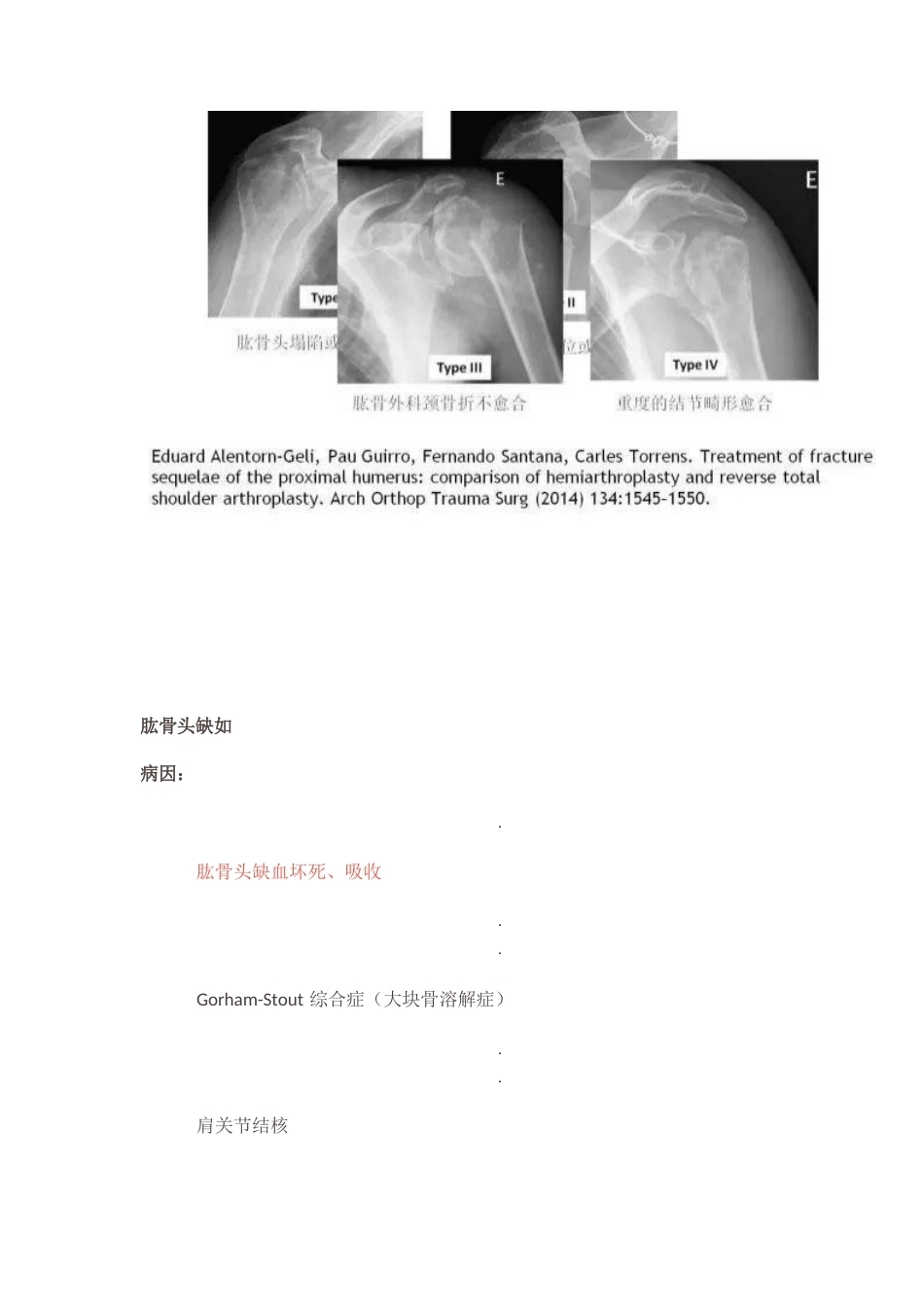 肩关节反向假体置换术 技巧_第12页