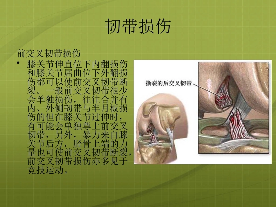膝关节 针灸治疗_第15页