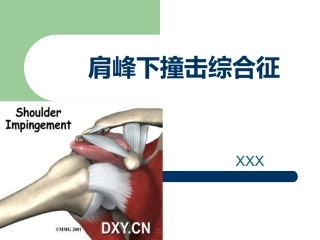肩峰下撞击综合征