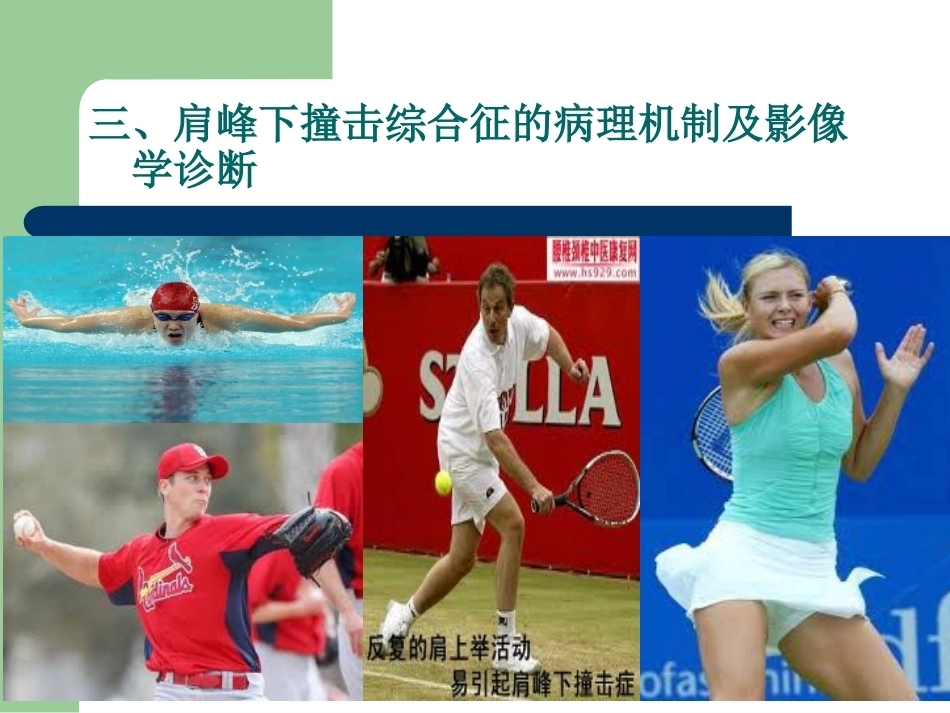 肩峰下撞击综合征_第12页