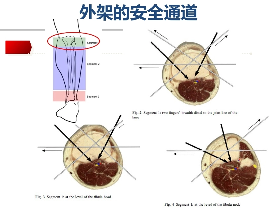 外架的基本 理论_第13页