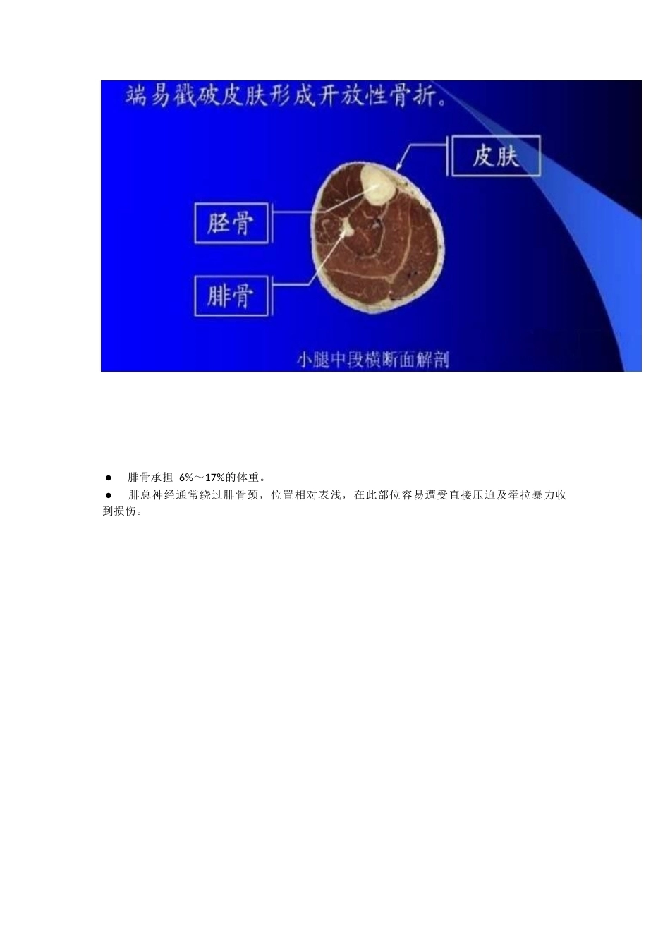 胫腓骨骨折的治疗 方法_第3页