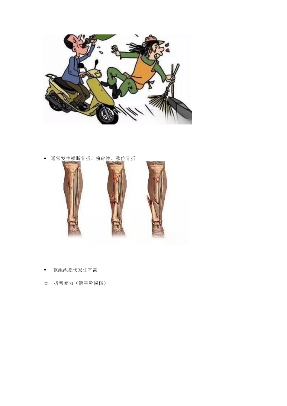 胫腓骨骨折的治疗 方法_第5页