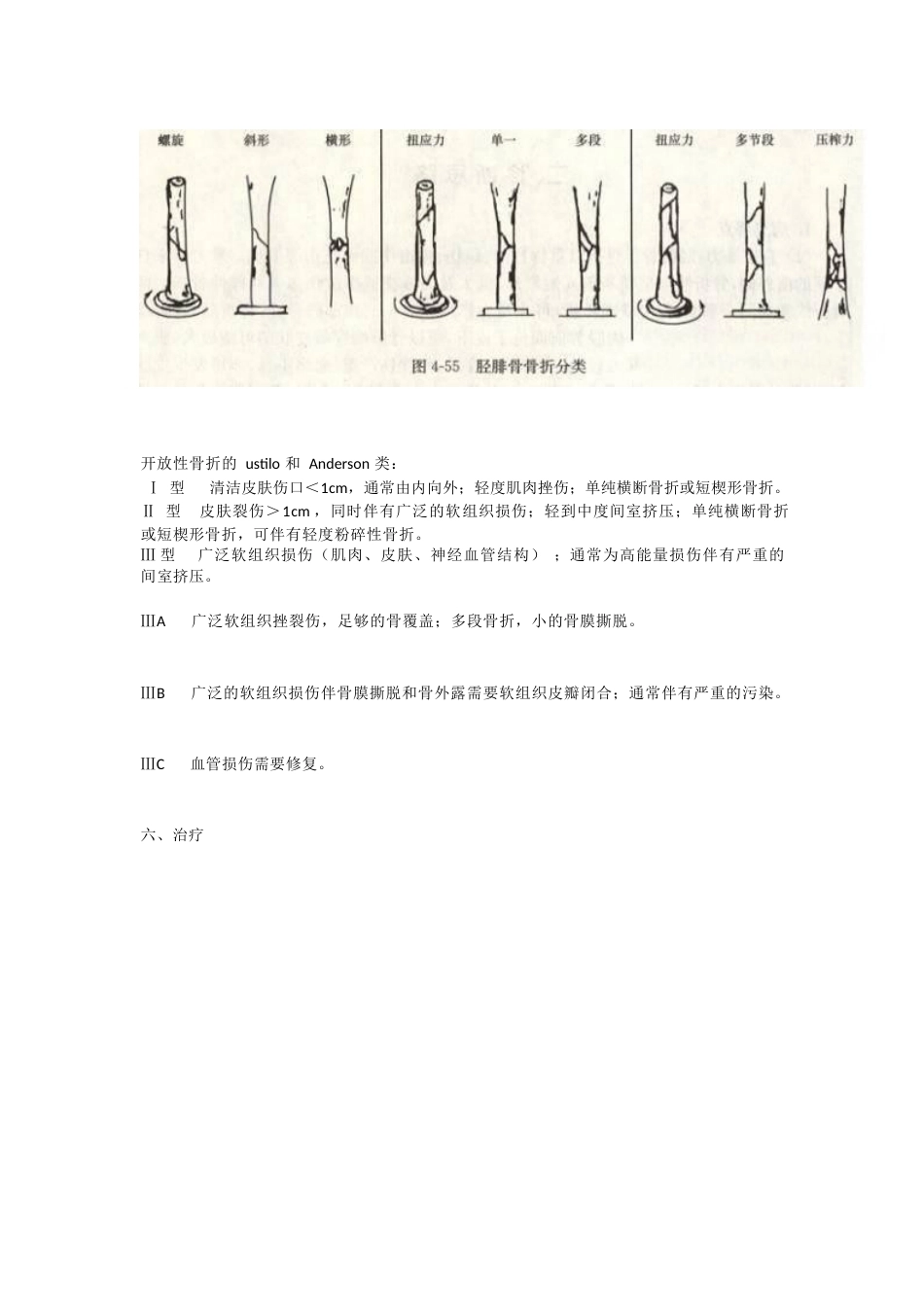 胫腓骨骨折的治疗 方法_第9页