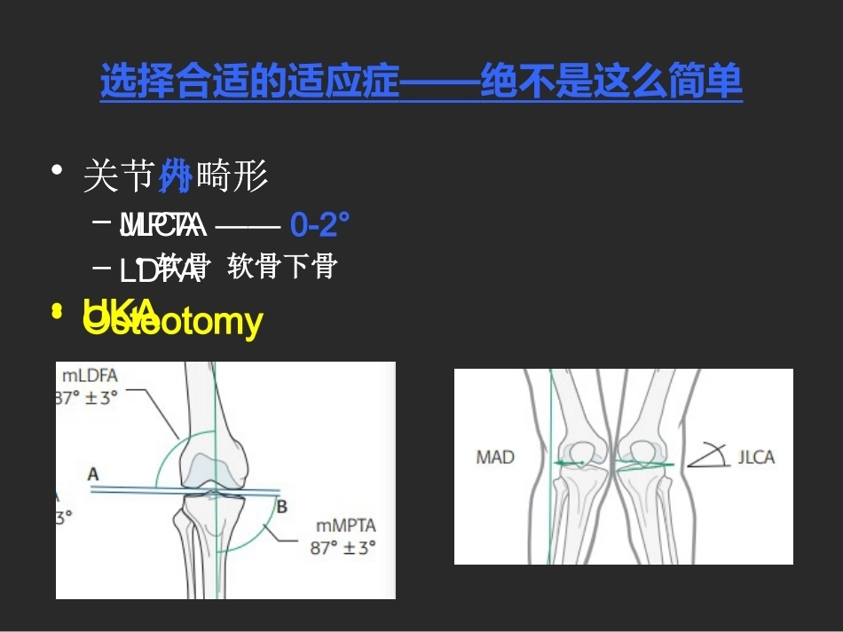 下肢截骨的 基本原则_第10页