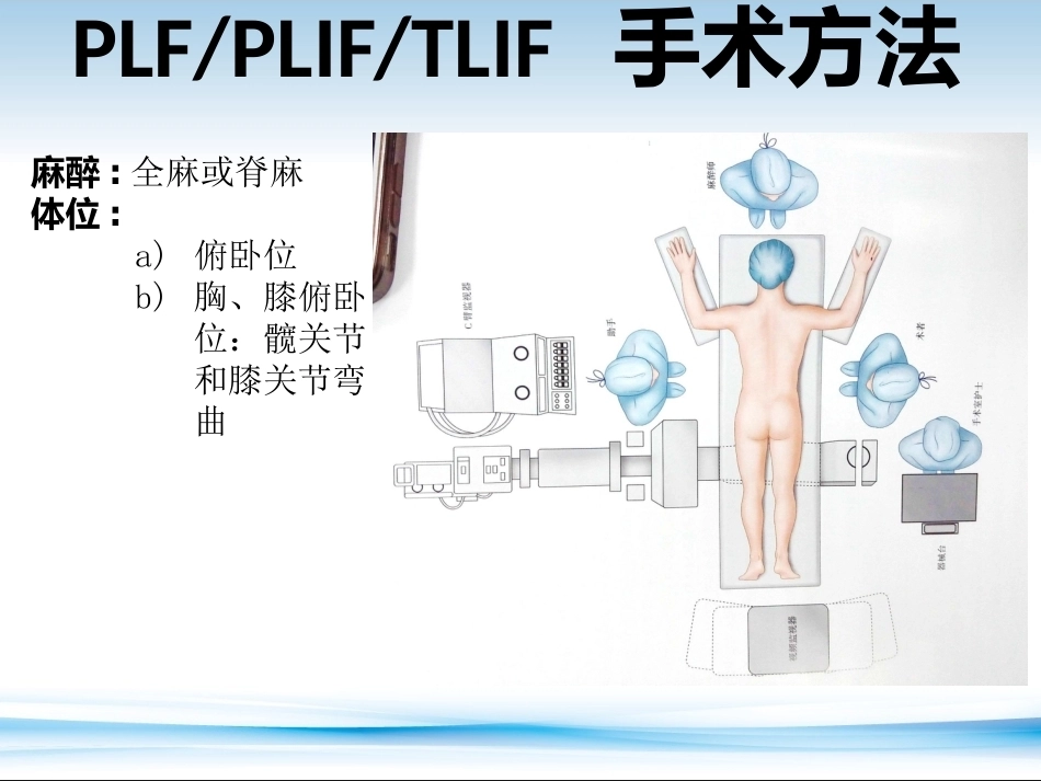 XLIF的技术对比_第4页