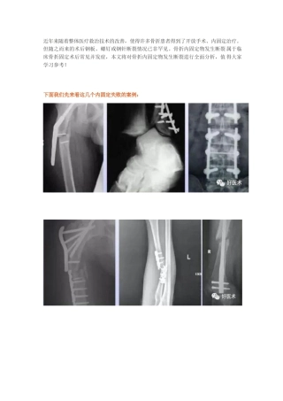 骨科内固定物 断裂原因分析