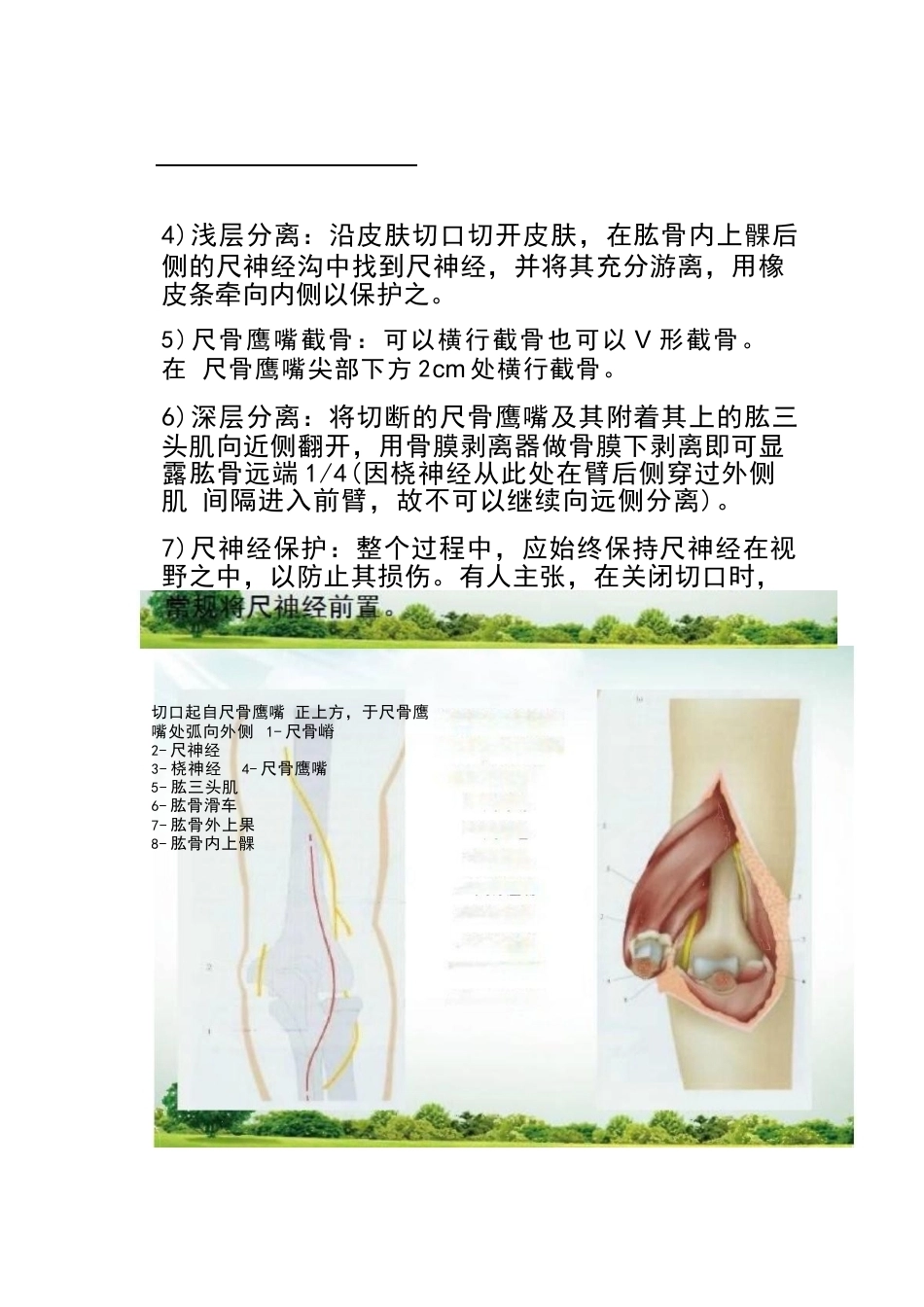肱骨踝间骨折手 术技巧_第9页