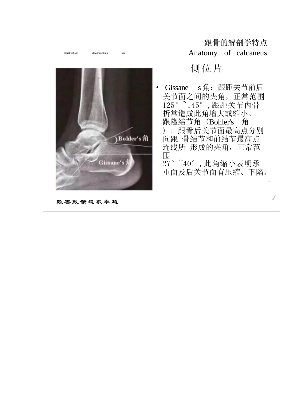 跟骨骨折的分型详解_第3页