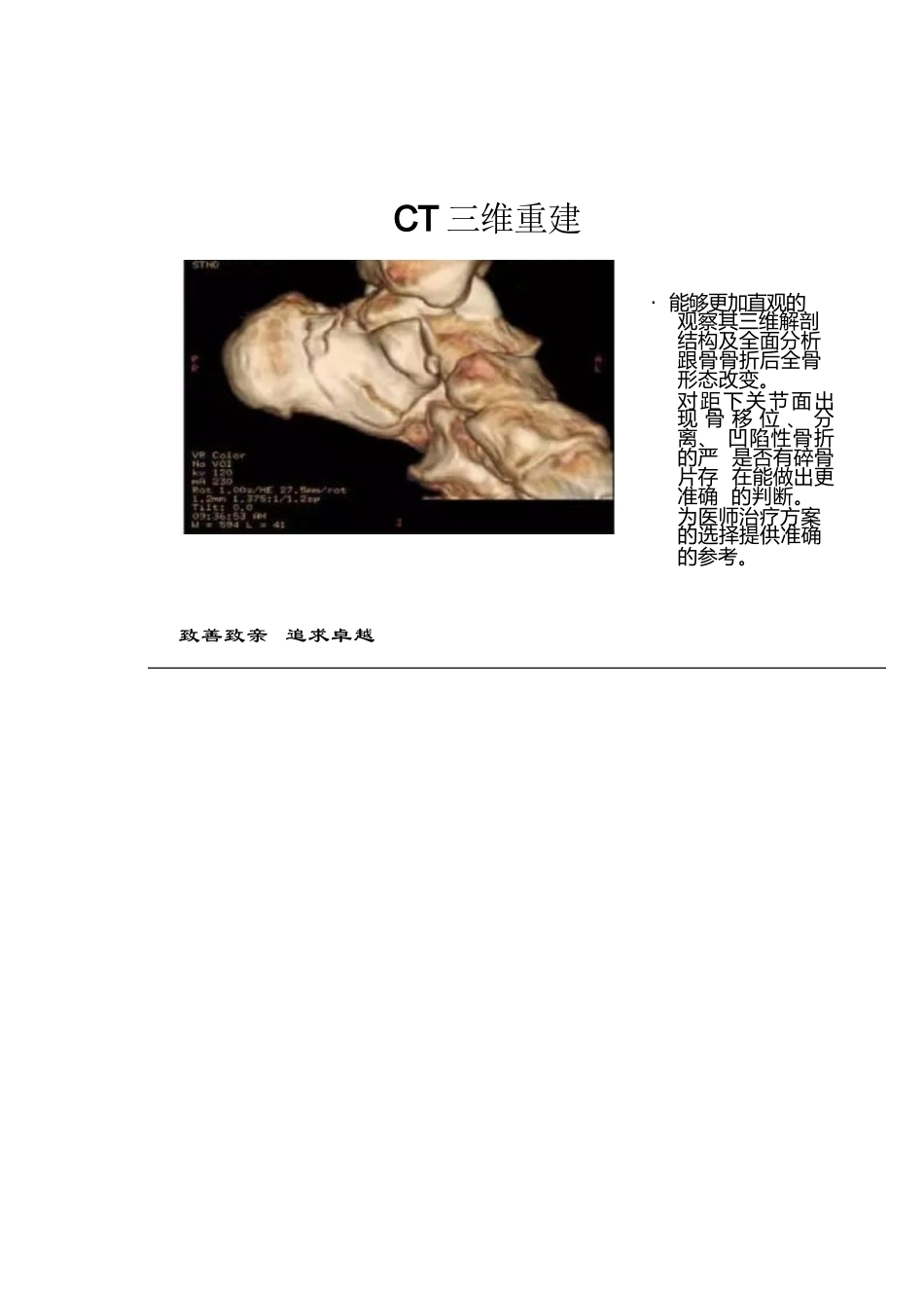 跟骨骨折的分型详解_第6页