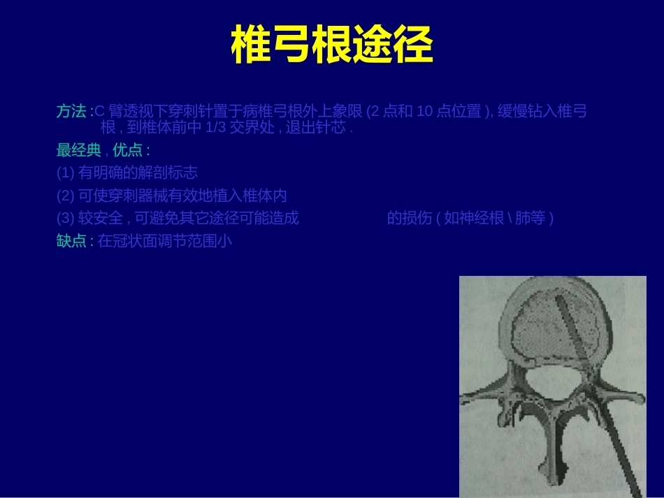 椎体成 形术_第15页