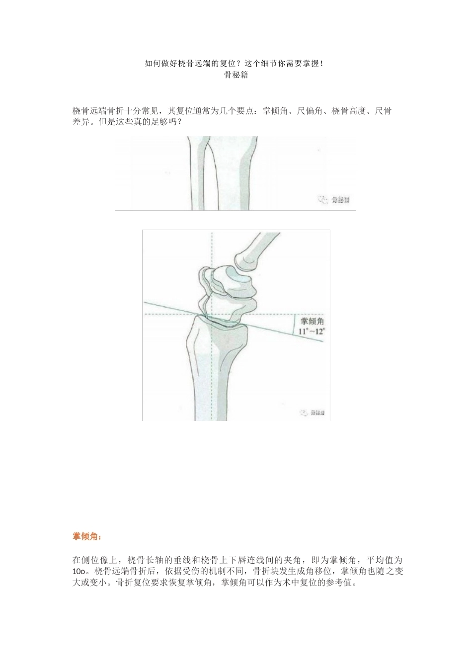 桡骨远 端的复位细节_第1页