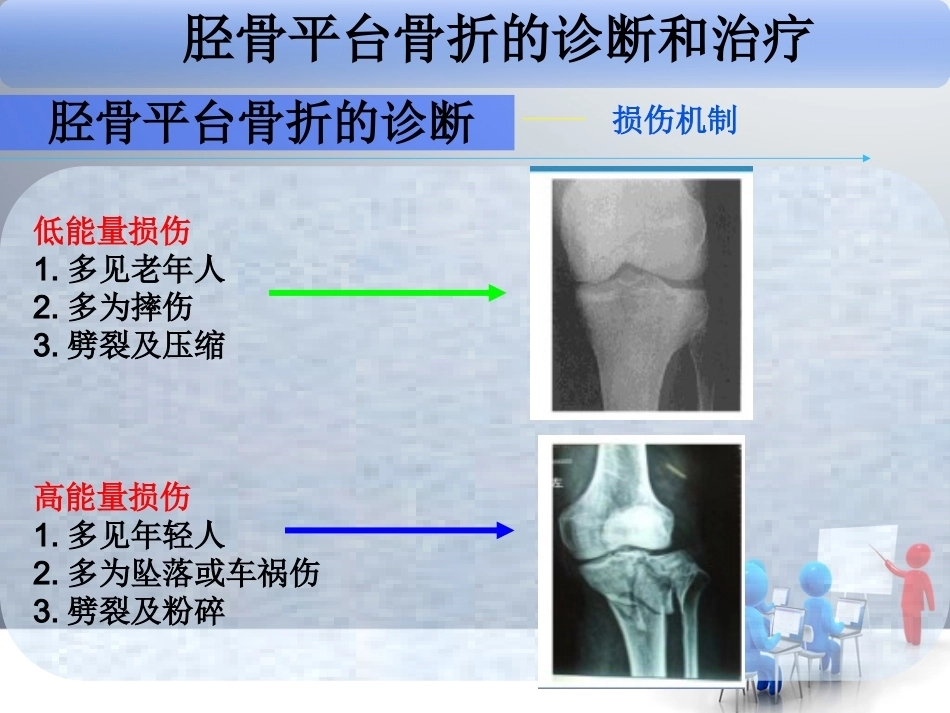 胫骨平 台骨折_第14页