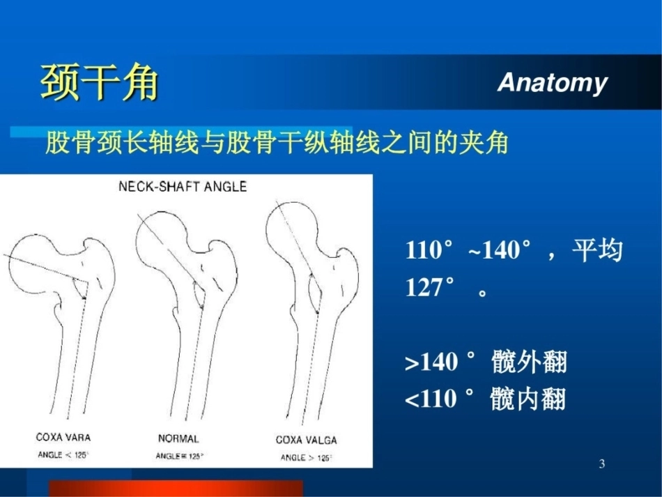 股 骨颈骨折ppt_第3页