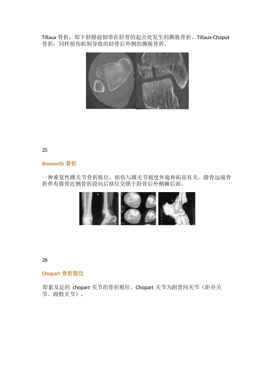 三十八种特殊类型的骨折_第14页