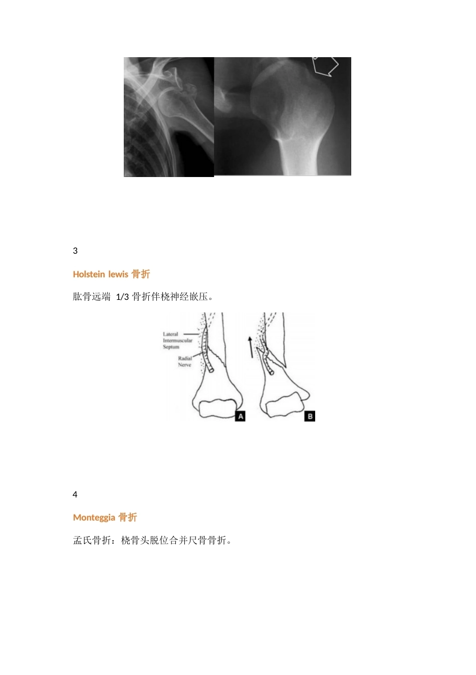 三十八种特殊类型的骨折_第2页