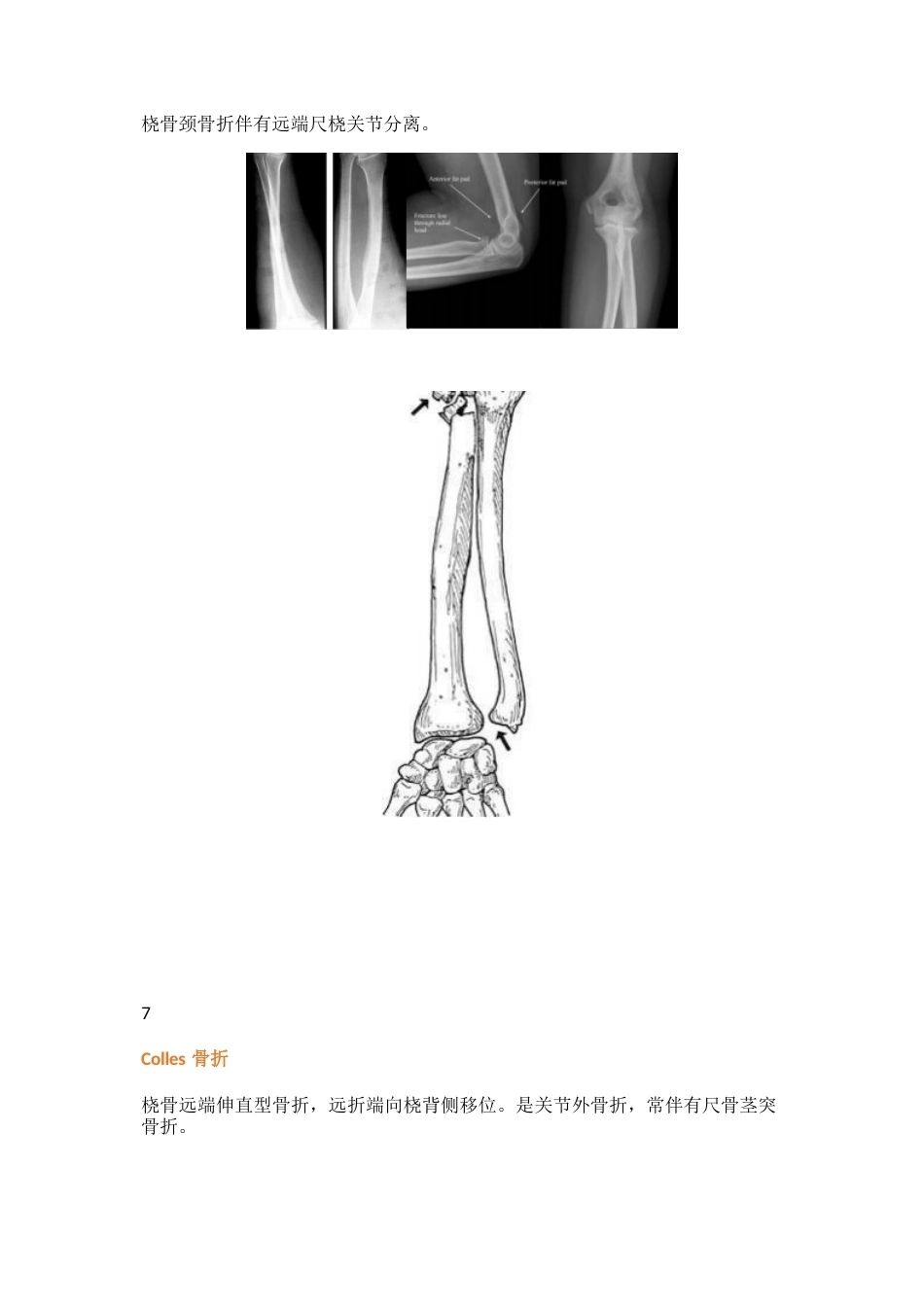 三十八种特殊类型的骨折_第4页