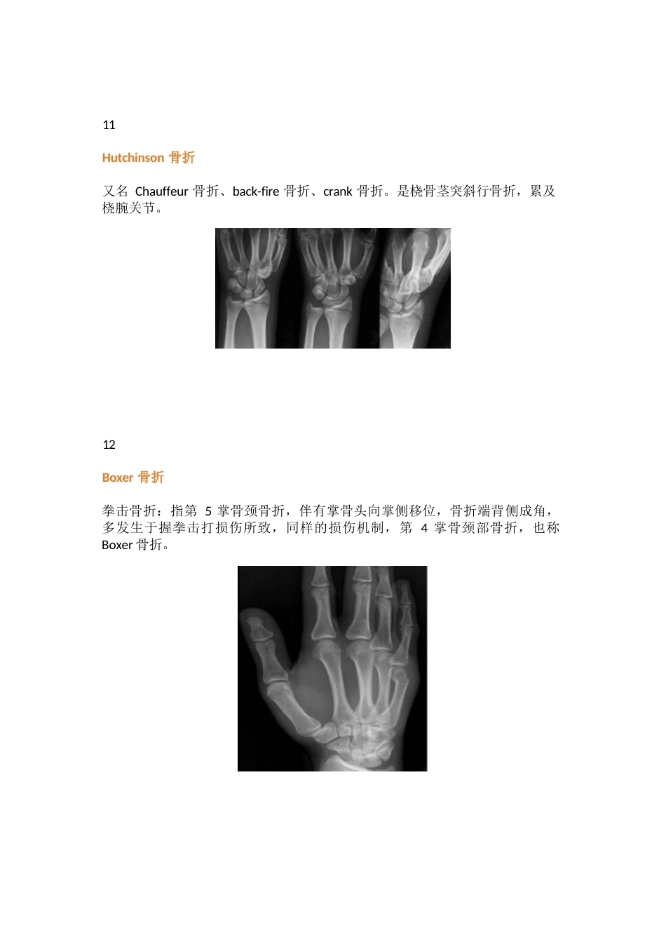 三十八种特殊类型的骨折_第7页