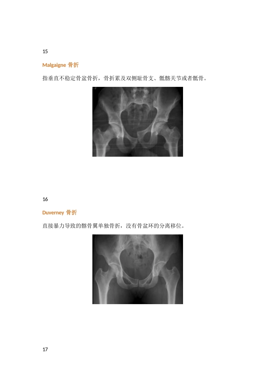 三十八种特殊类型的骨折_第9页