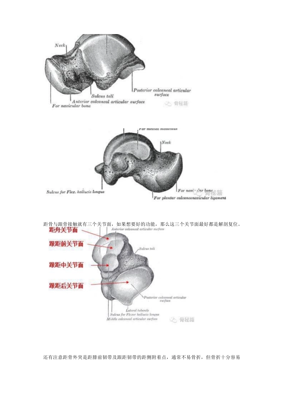距骨骨折的手术细节 与入路_第2页