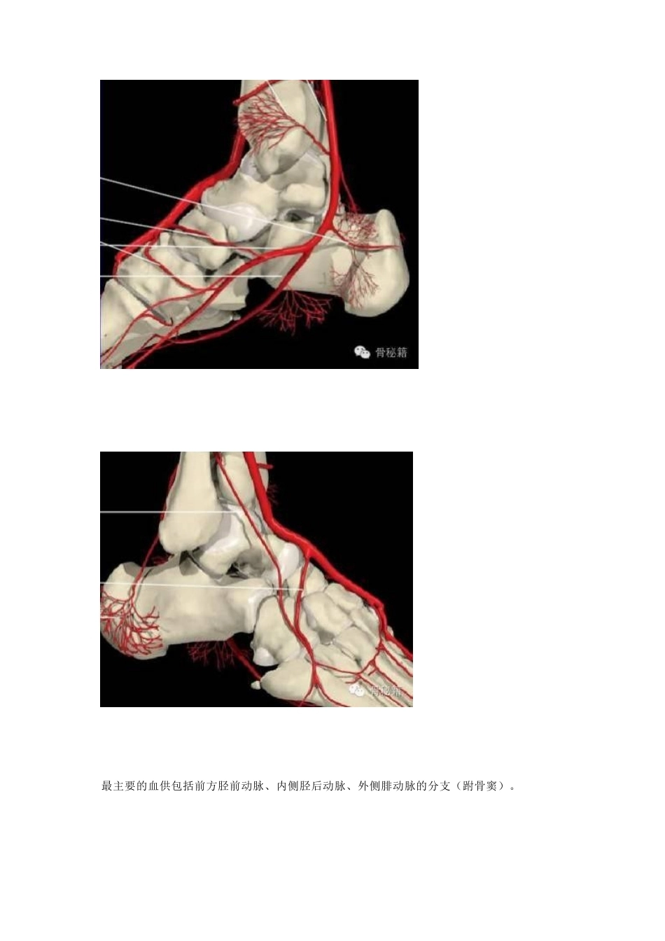 距骨骨折的手术细节 与入路_第4页