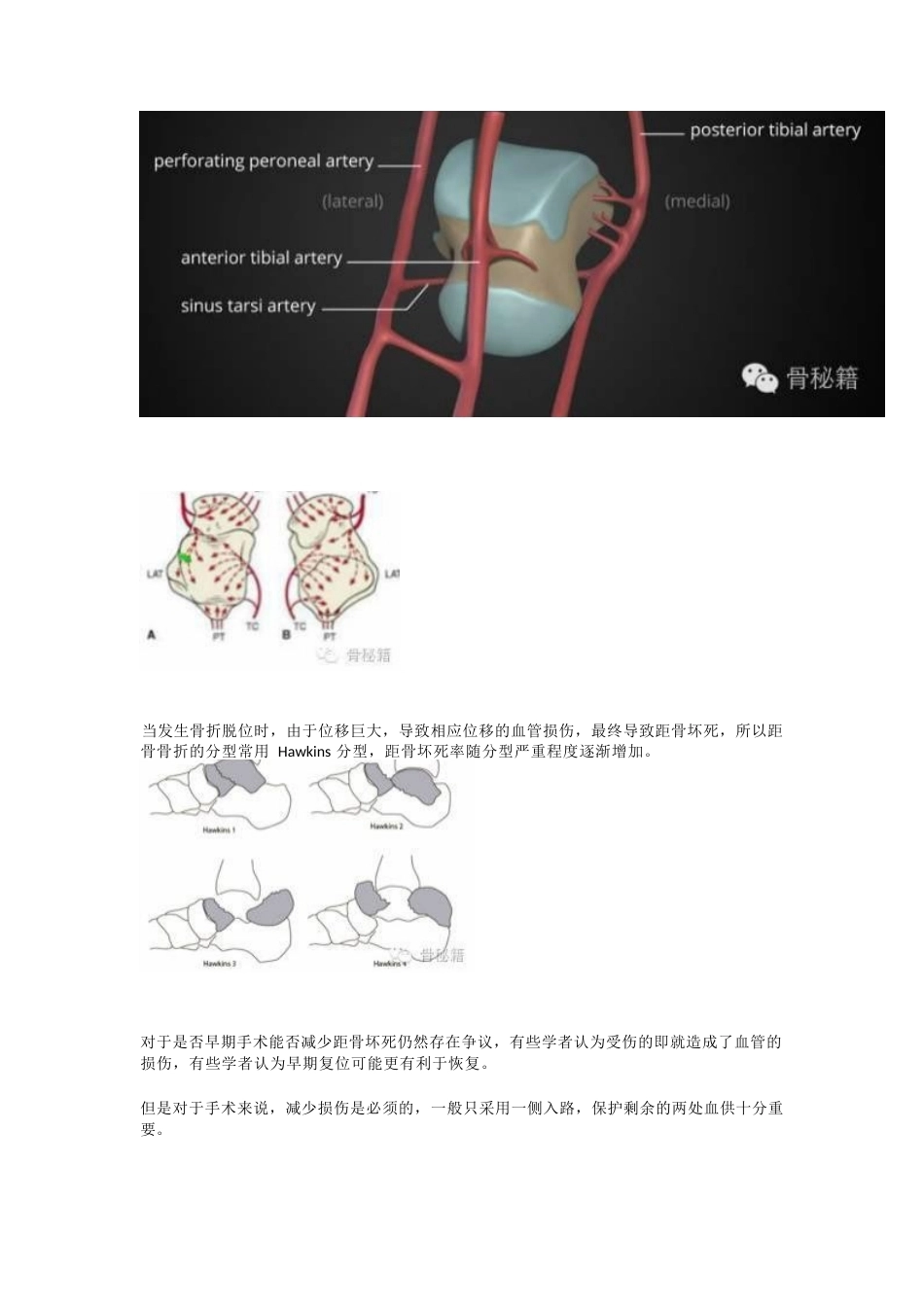 距骨骨折的手术细节 与入路_第5页