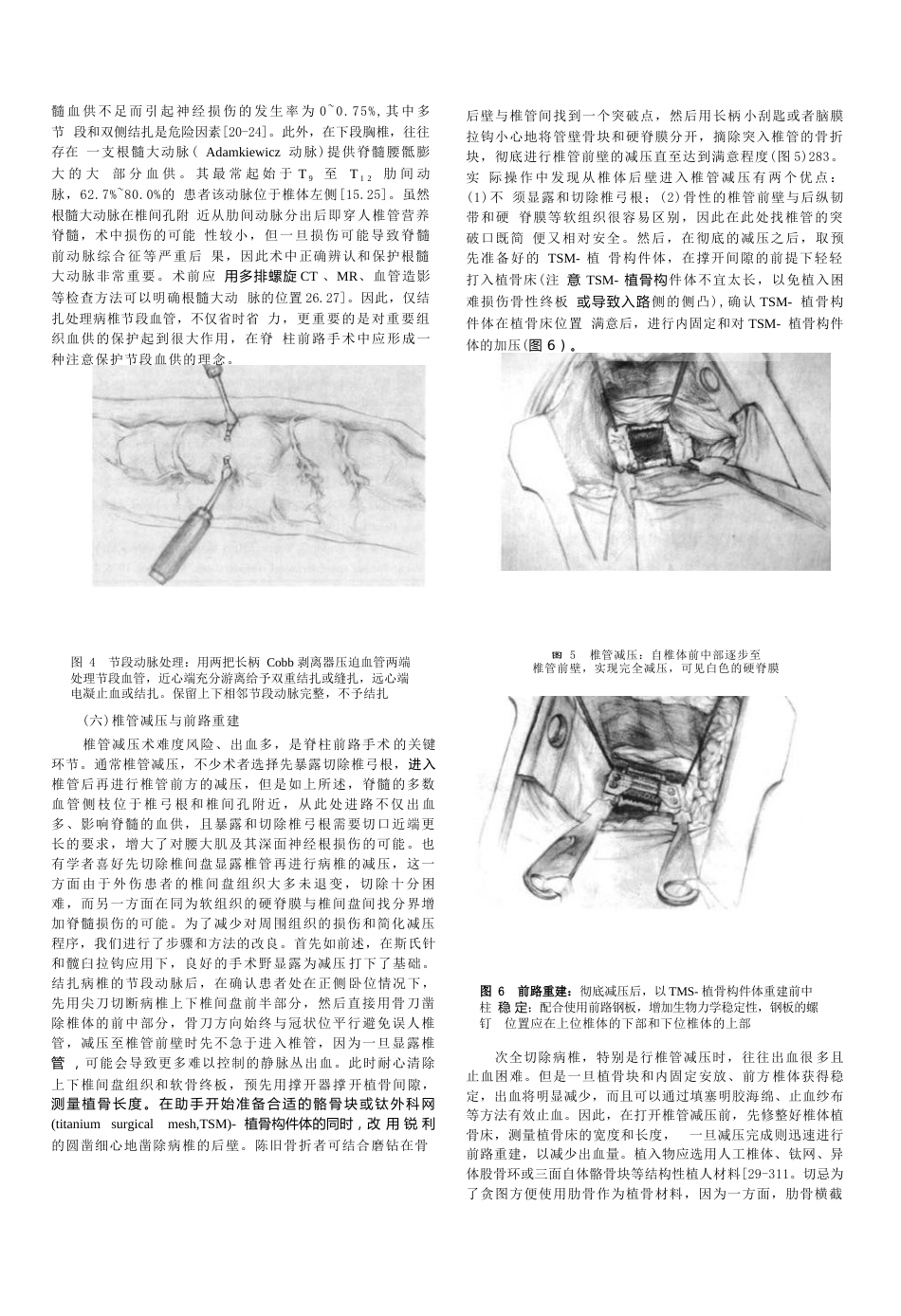 骨科教程：胸腰椎骨 折前路手术技术改良_第3页