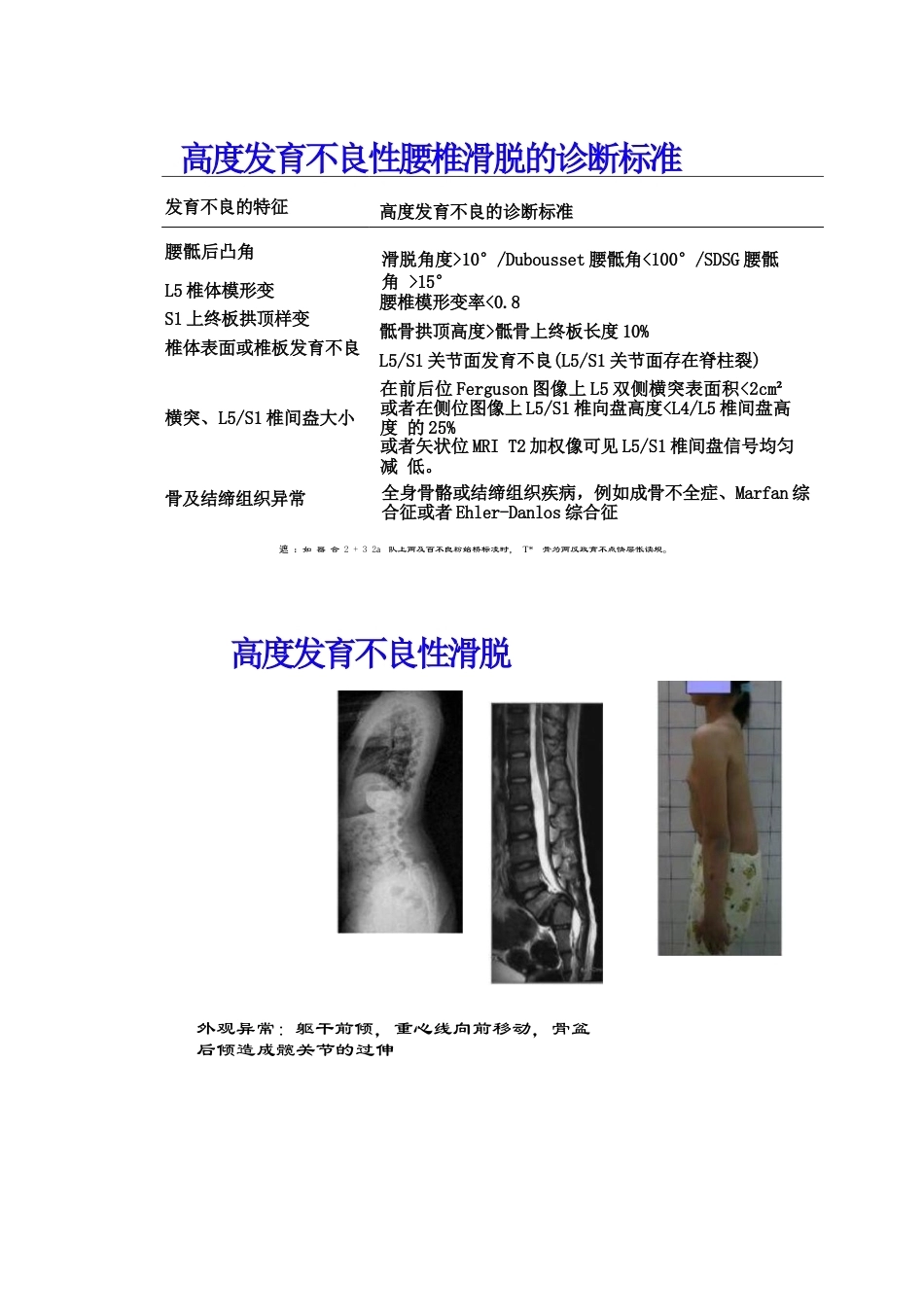 腰椎滑脱的临床分型_第7页