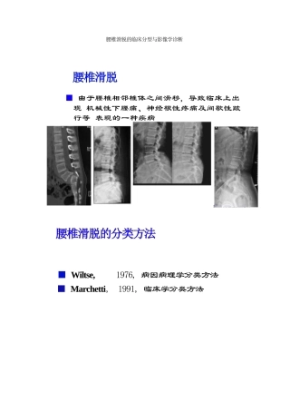 腰椎滑脱的临床分型