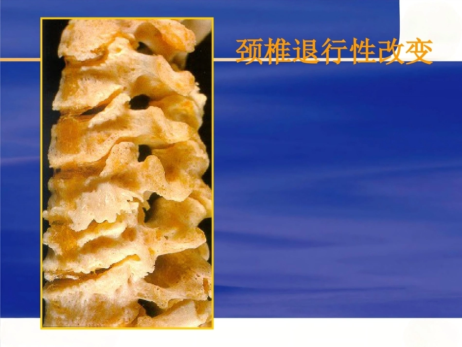 颈椎病的临床诊治PPT_第10页