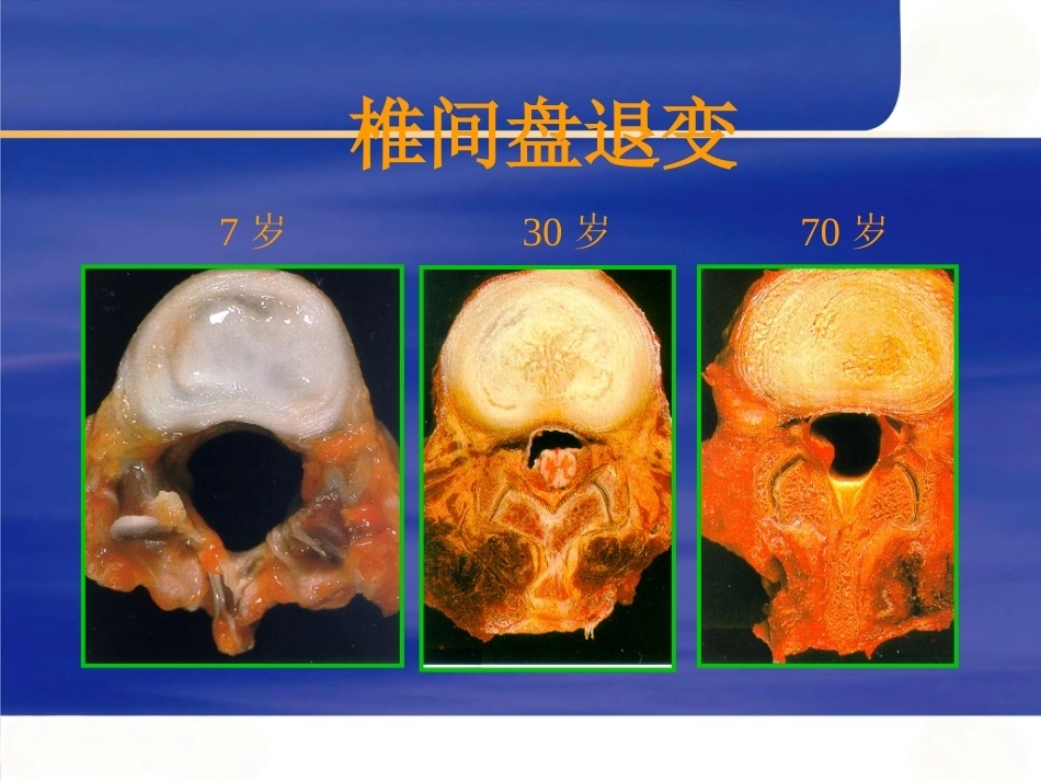 颈椎病的临床诊治PPT_第9页