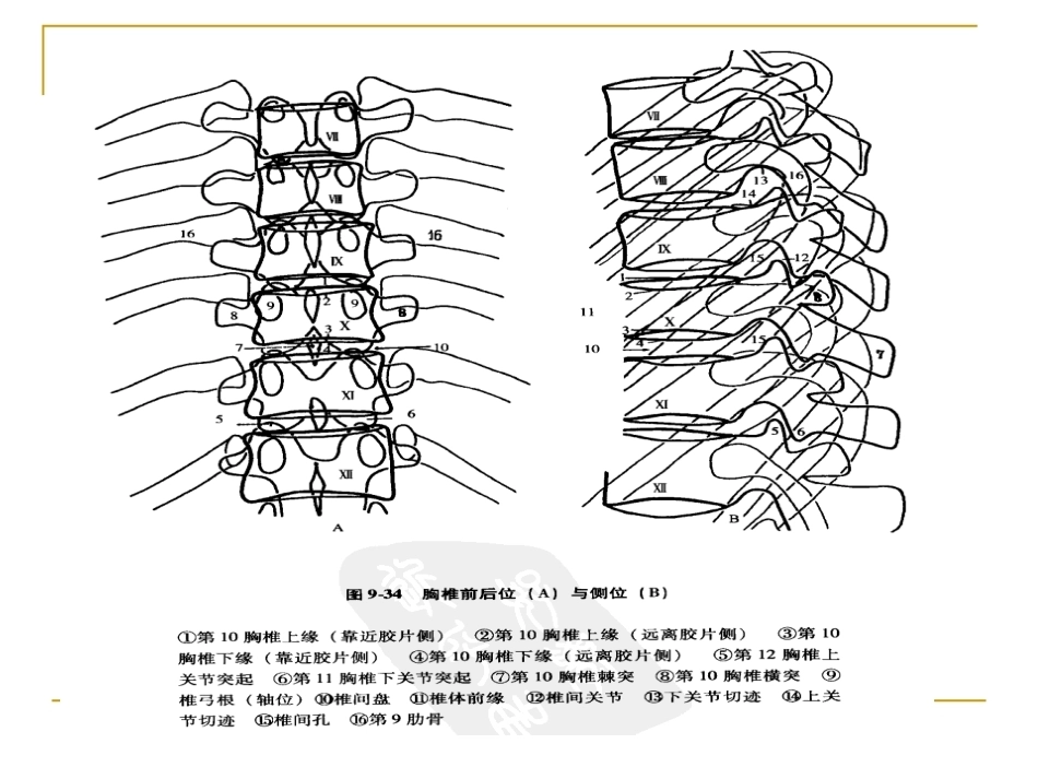脊柱x片 诊断_第10页