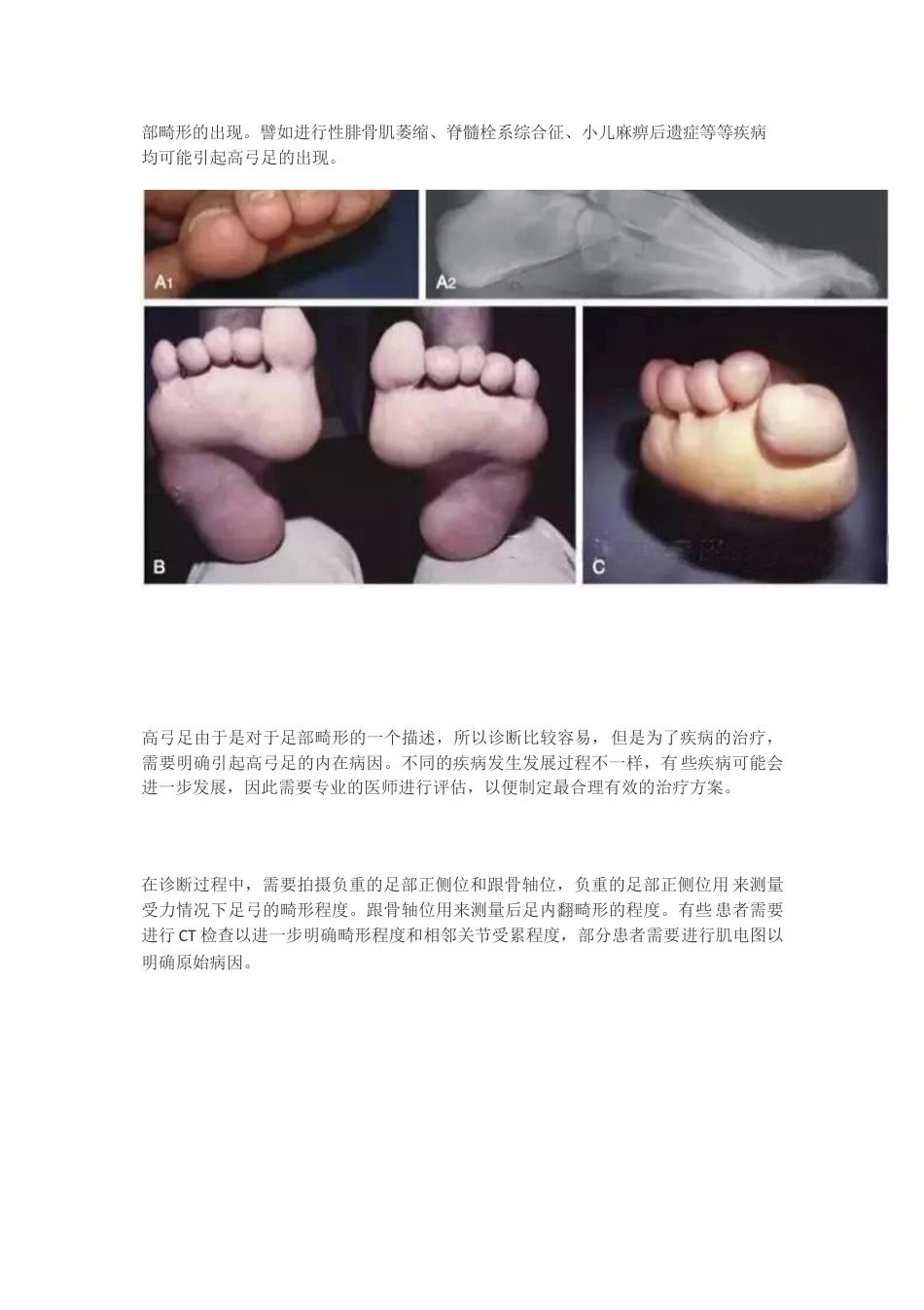 高弓足的分型_第3页